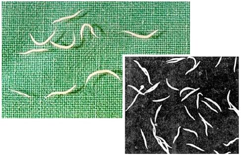 Pinworms from Humans