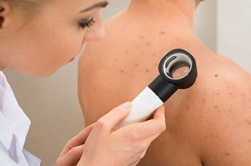rash with parasites on the skin
