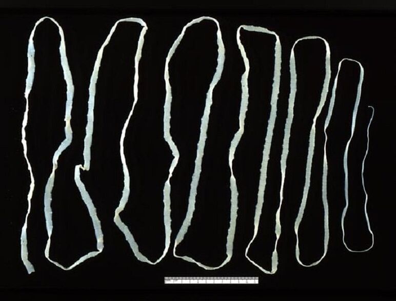 Tapeworms extracted from the human gut