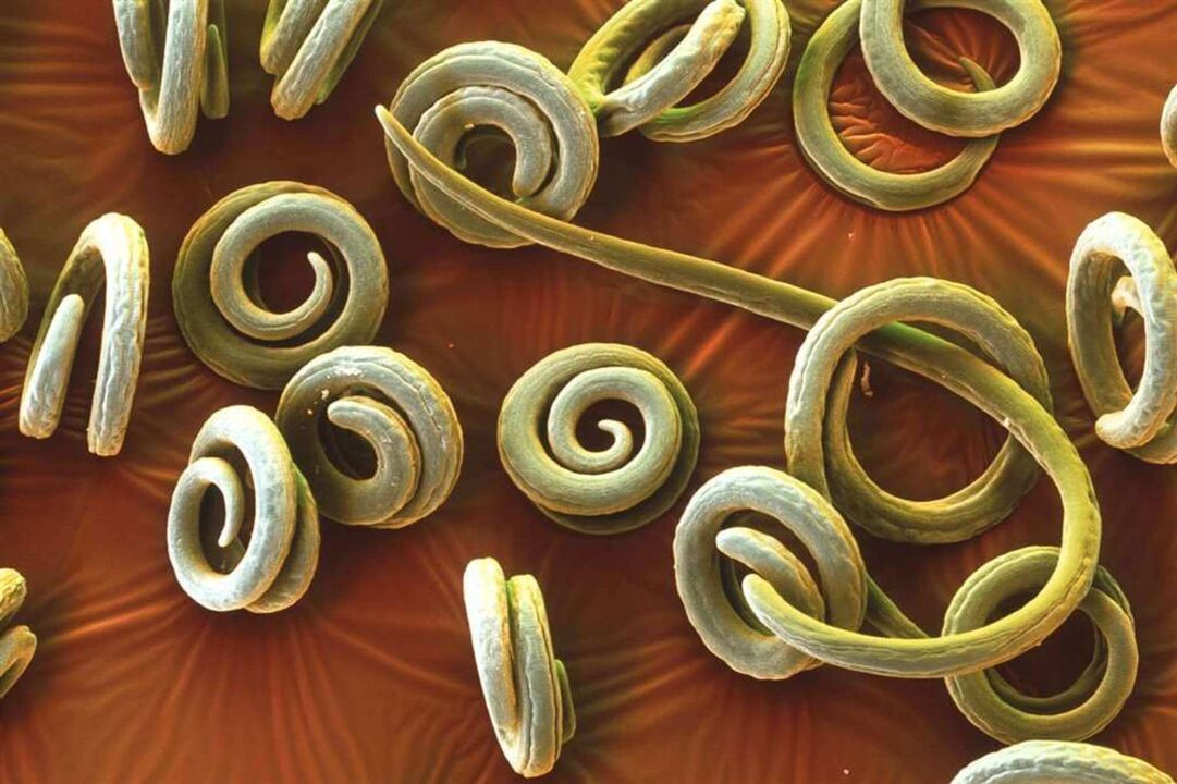 worm parasites from humans