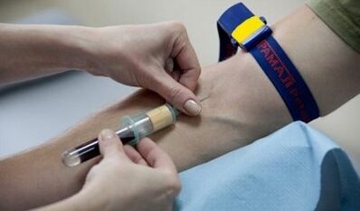 How to prepare for parasite tests