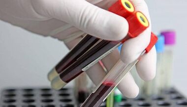 How to test for in vivo parasites