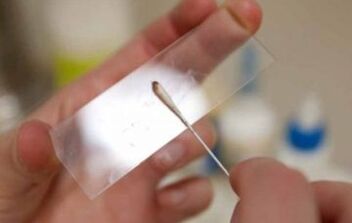 What tests should be performed on parasites
