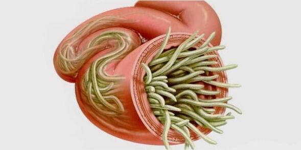 worms in human body