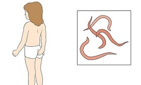 Symptoms of parasites in the human body