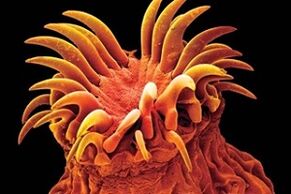 human flukes parasites