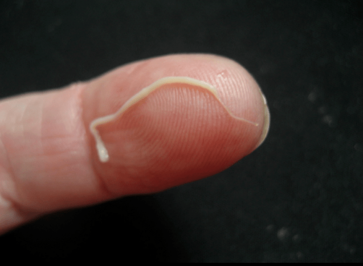 Roundworm parasites from humans