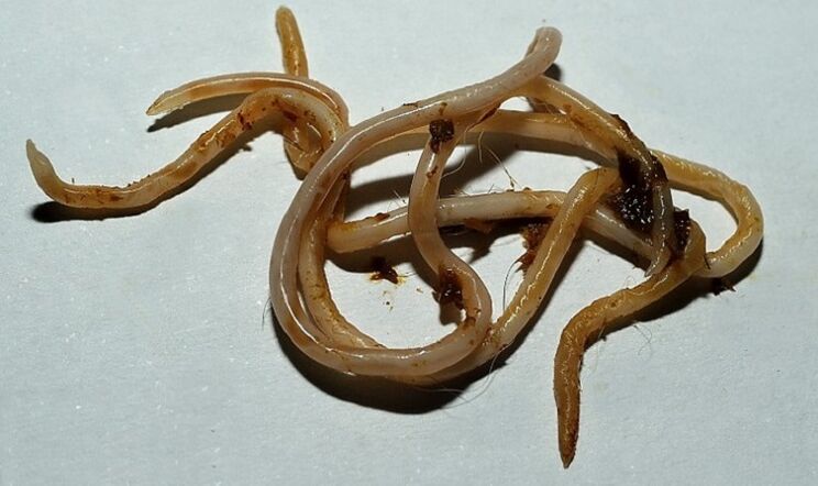 Toxocara from humans